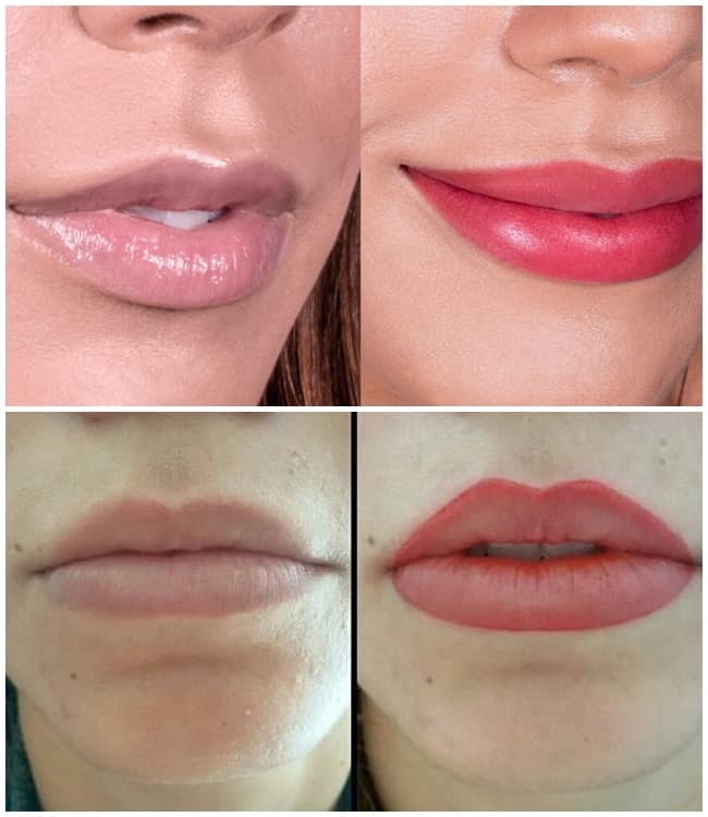 fotos de labios pigmentados