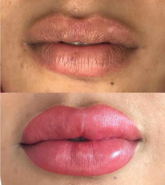 antes e depois de labios grossos com micropigmentacao