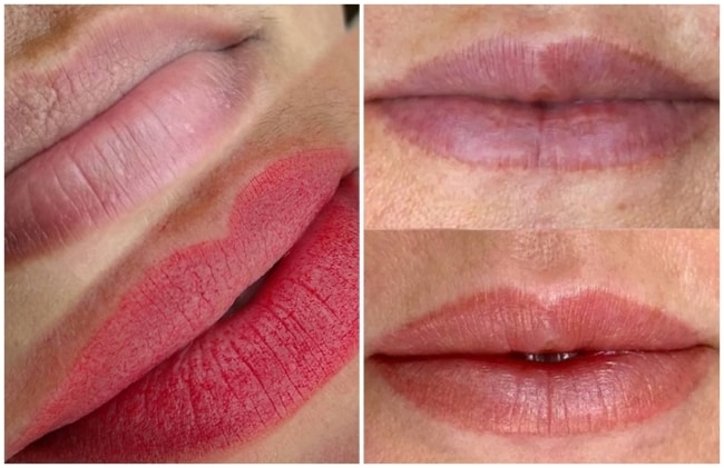 resultados de labios com micropigmentacao