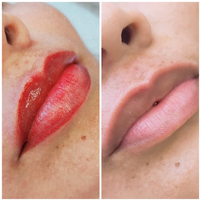 antes e depois de labios micropigmentados em vermelho