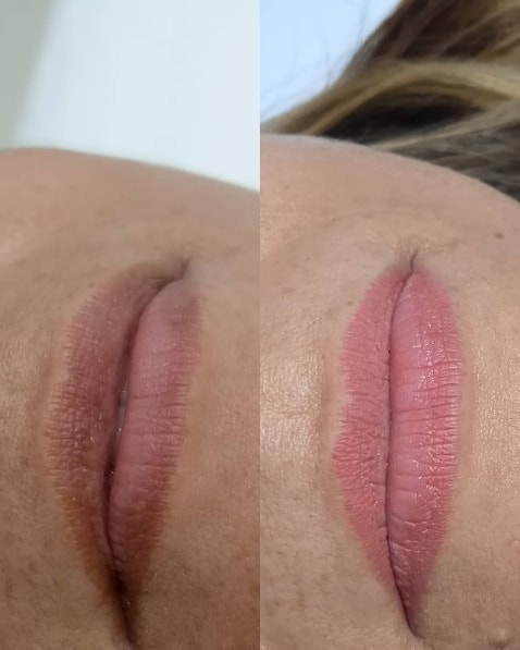 foto de boca antes e depois de micropigmentacao