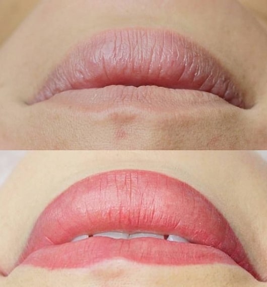 antes e depois de micropigmentacao labial com cor natural