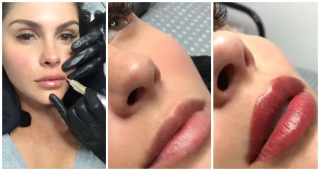antes e depois de micropigmentacao labial Barbara Evans