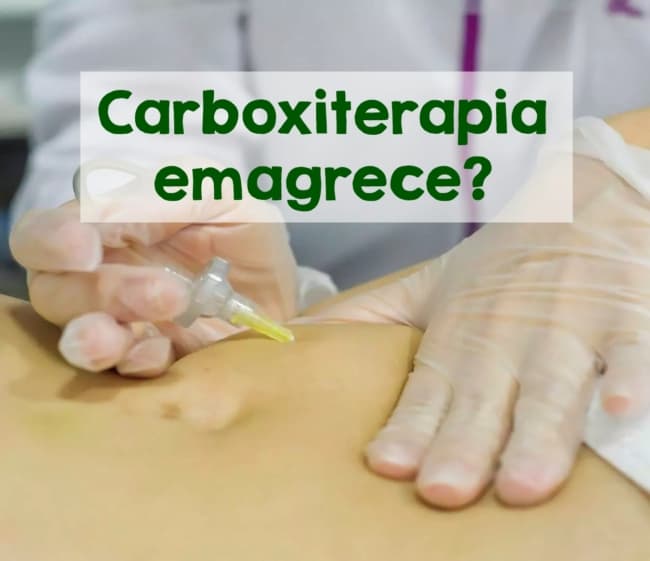 carboxiterapia emagrece