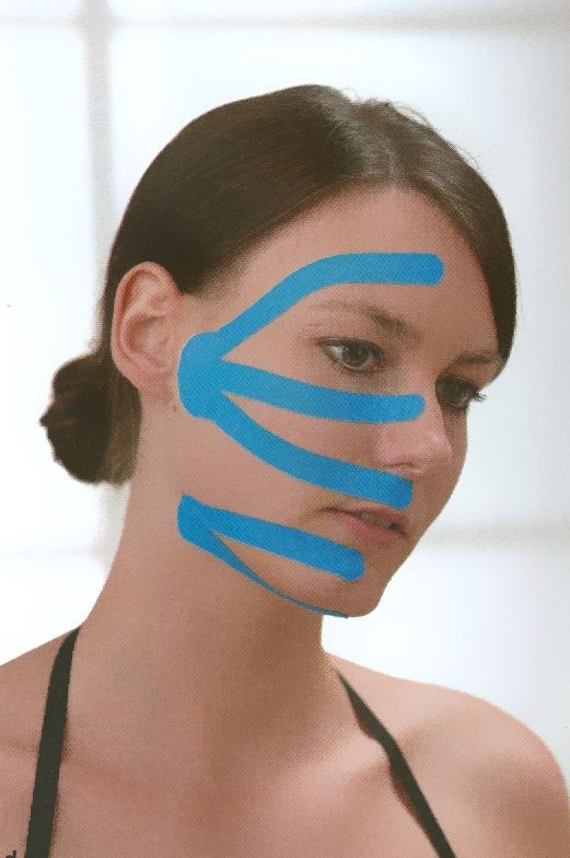 face taping