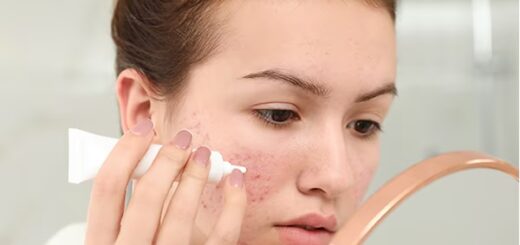 11 dicas para cuidar de pele com manchas de espinha BeBeautiful