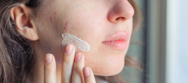 21 rotina cuidados pele acneica Reequil