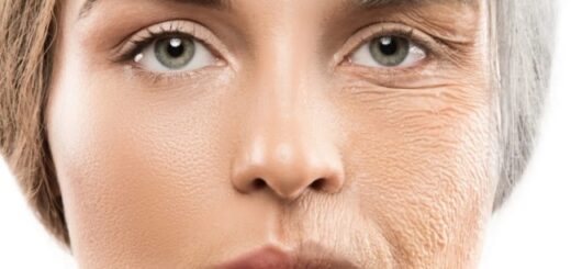 1 o que é envelhecimento da pele AnewSkin Aesthetic Clinic and Medical Spa