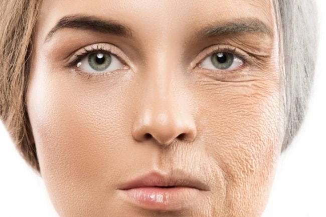 1 o que é envelhecimento da pele AnewSkin Aesthetic Clinic and Medical Spa