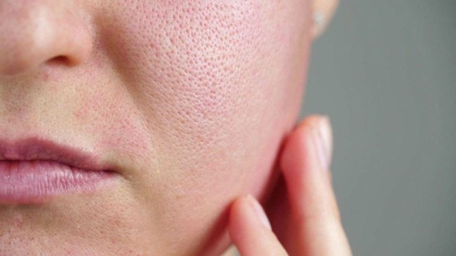 2 causas pele sensível bareLUXE Skincare